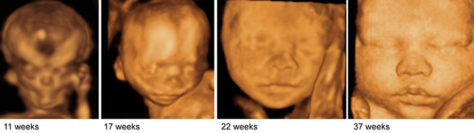26 week 4d ultrasound