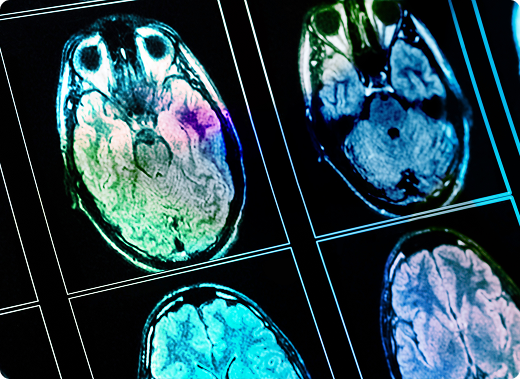 PET-content Colorful images of a patient’s brain from a PET scan completed at a diagnostic imaging center
